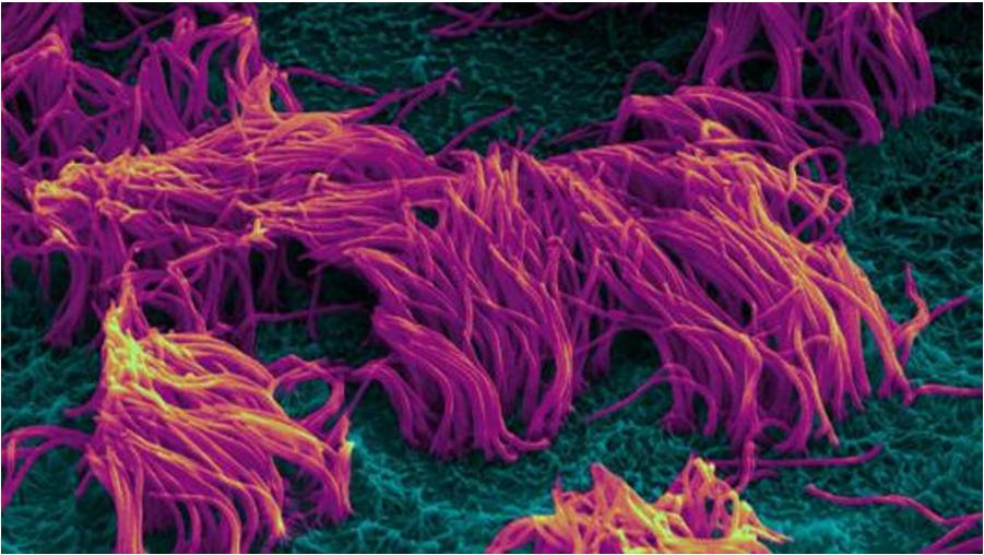 微流控微通道呼吸道芯片