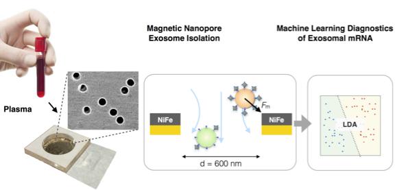 納米流控技術(shù)與機(jī)器學(xué)習(xí)相結(jié)合利用外泌體精確診斷胰腺癌