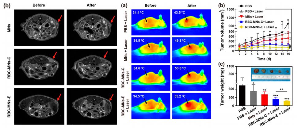 電穿孔包膜技術應用于腫瘤MRI成像與光熱治療