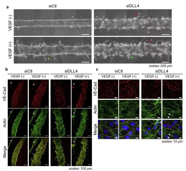 敲除DLL4將影響血管的新生和穩(wěn)定性。圖片來源：EBioMedicine