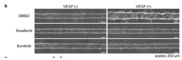 向芯片中添加抗腫瘤藥物sorafenib或sunitinib，觀察到了血管新生的抑制現(xiàn)象。 圖片來源：EBioMedicine