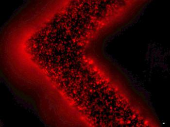 細(xì)胞外囊泡（紅色）從患者腫瘤細(xì)胞中釋放并被捕獲在EV-HB芯片表面。