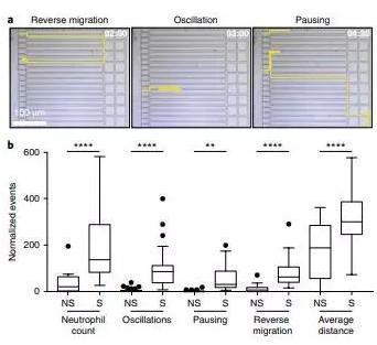 敗血癥特異性的中性粒細(xì)胞自發(fā)的遷移模式。