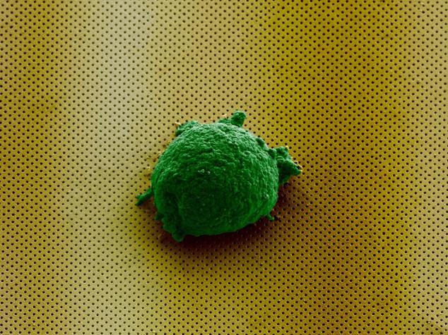 《Small》雜志封面圖片顯示，單個淋巴瘤細胞孤獨地存在于新型生物傳感器上。