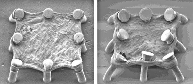 在微柱上培養(yǎng)的肺組織（左）和經(jīng)過TGF-beta處理后收縮并模擬纖維化的肺組織（右）
