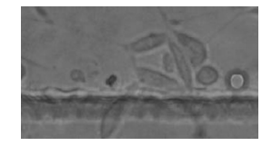 圖63T3細(xì)胞在培養(yǎng)箱外培養(yǎng)2d的照片