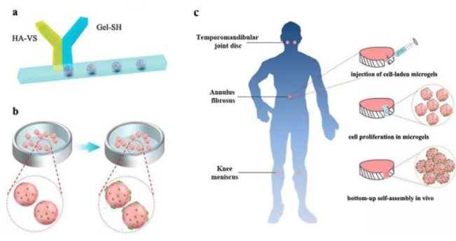 圖1：基于干細(xì)胞載體Gel-HA微凝膠的軟骨修復(fù)策略示意圖。